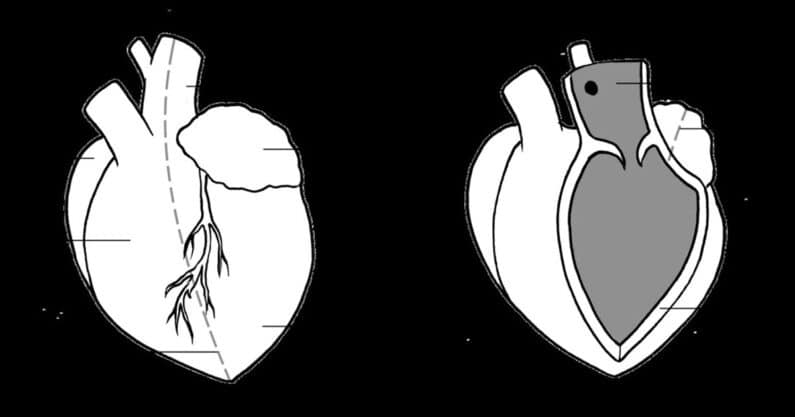 Heart dissection